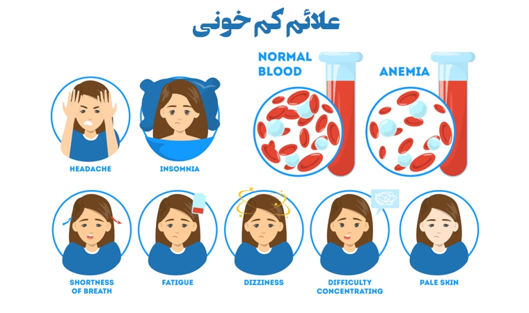 علائم کم خونی در زنان