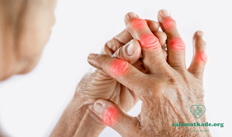 علائم روماتیسم عصبی