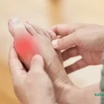 دشمن اسید اوریک بالا