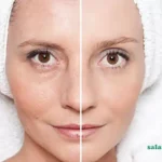 علت پیری زودرس پوست