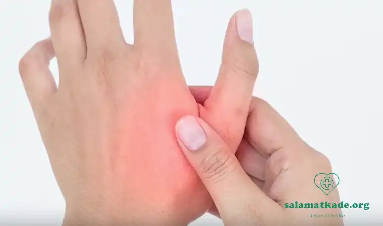 علائم آرتروز دست و پا و 5 روش درمان گیاهی آن