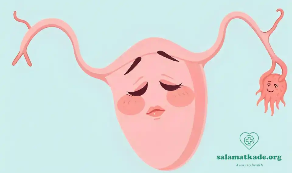 سریعترین درمان تنبلی تخمدان با طب سنتی