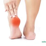 علت داغی کف پا در طب سنتی