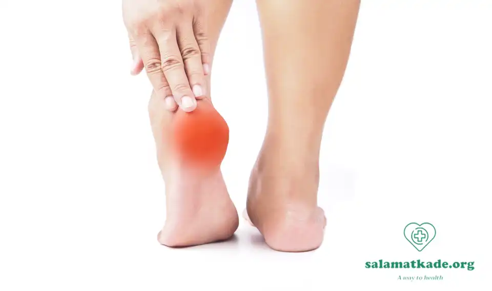 علت داغی کف پا در طب سنتی