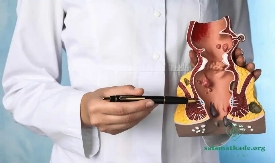 علت خارش مقعد و درمان آن