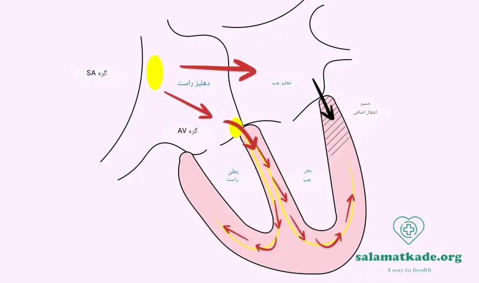 سندروم ولف پارکینسون یکی از بیماری های قلبی 