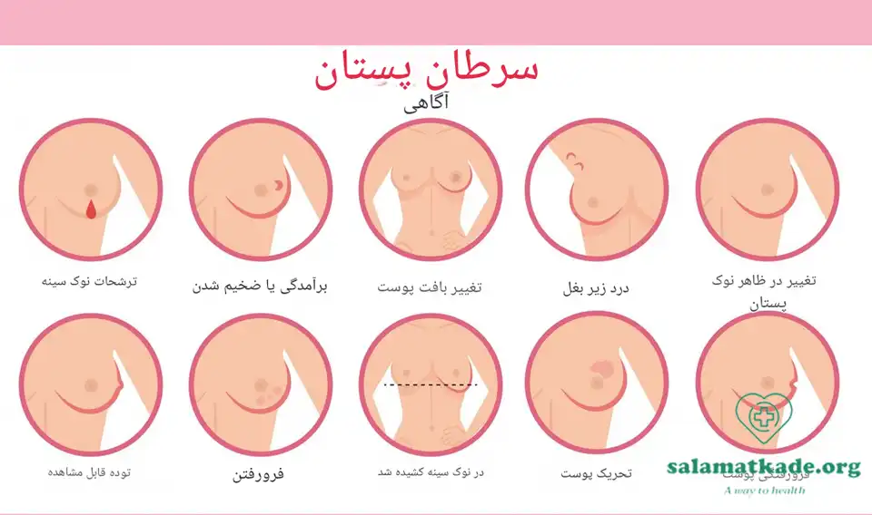 علائم سرطان پستان
