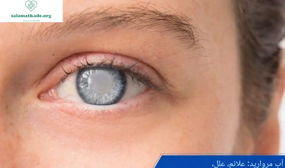 درمان آب مروارید با طب سنتی