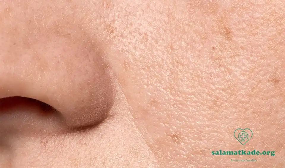 منافذ باز پوست 
