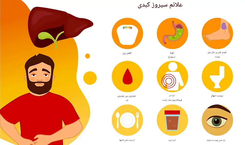 علائم سیروز کبدی و هشدارهای آن 