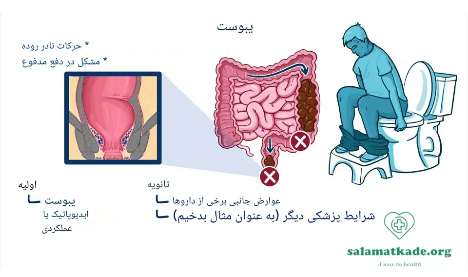 علائم یبوست چیست