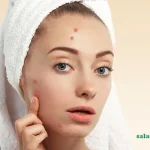 از بین بردن جوش صورت