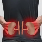 علائم نارسایی کلیه از اولیه تا پیشرفته