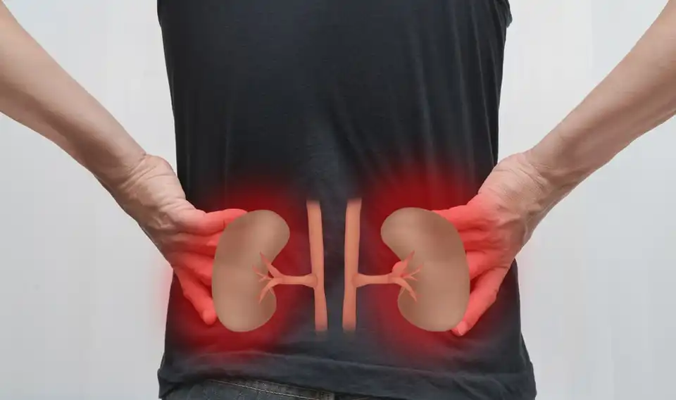 علائم نارسایی کلیه از اولیه تا پیشرفته