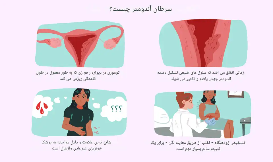 علائم سرطان رحم و انواع آن