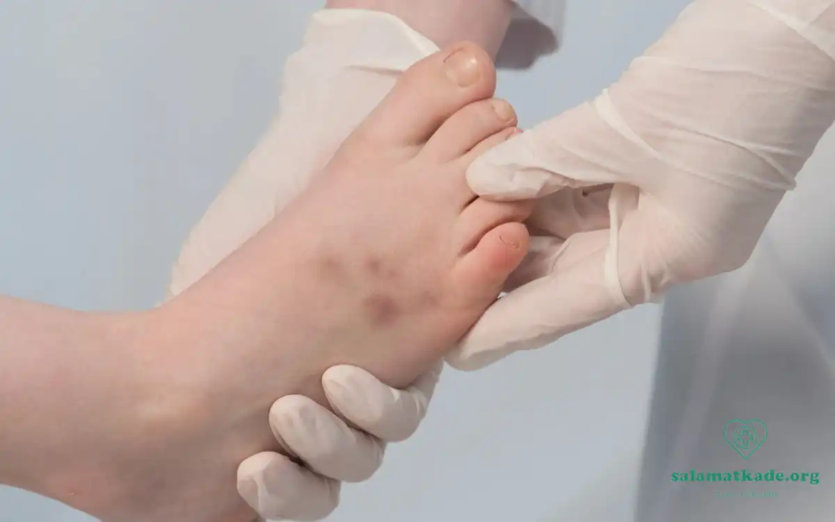 علت کبودی بدن بدون ضربه