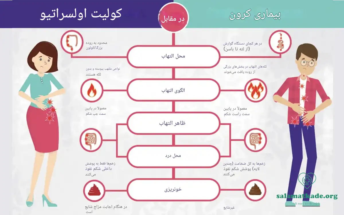 تفاوت نشانه های بیماری کرون و کولیت اولسراتیو