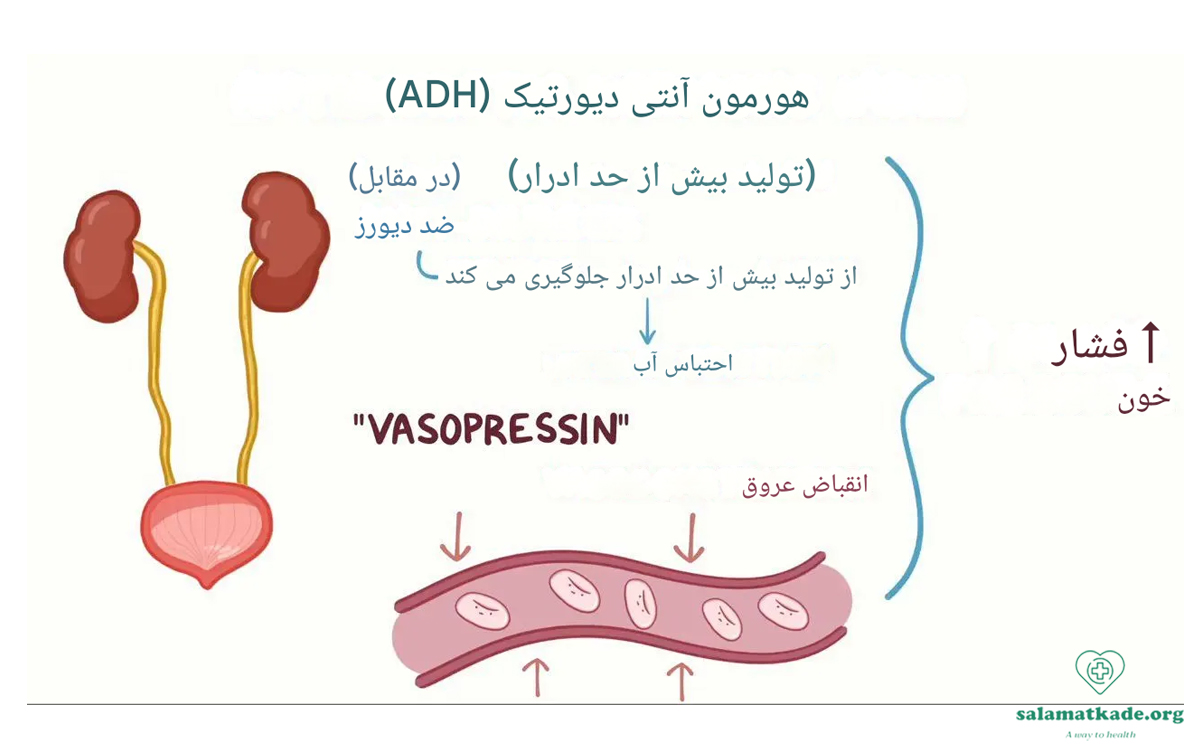 هورمون آنتی دیورتیک