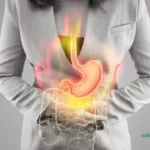 غذاهای مفید و مضر برای رفلاکس معده