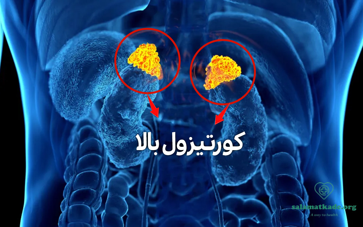 کورتیزول بالا
