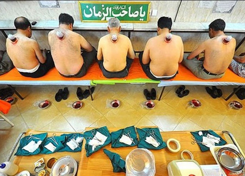 حجامت